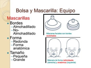 Bolsa y Mascarilla: Equipo
Mascarillas
   Bordes
    –Almohadillado
    –No-
     Almohadillado   Máscaras faciales con bordes
                     acolchados
   Forma
    –Redonda
    –Forma
     anatómica
   Tamaño
    –Pequeña
    –Grande           Máscara de forma redondeada
                      (derecha) y anatómica (izquierda)
 