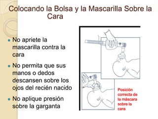 Colocando la Bolsa y la Mascarilla Sobre la
           Cara


   No apriete la
    mascarilla contra la
    cara
   No permita que sus
    manos o dedos
    descansen sobre los
    ojos del recién nacido      Posición
                                correcta de
   No aplique presión          la máscara
                                sobre la
    sobre la garganta           cara
 