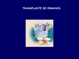 TRANSPLANTE DE ORGANOS
 