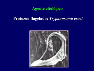 Agente etiológico

Protozoo flagelado: Trypanosoma cruzi
 