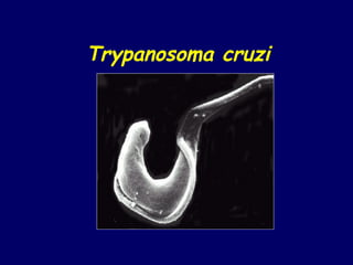 Trypanosoma cruzi
 