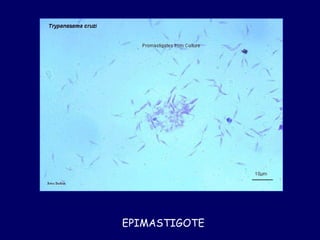 EPIMASTIGOTE
 