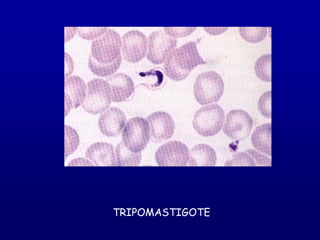 TRIPOMASTIGOTE
 