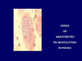 NIDOS

      DE

 AMASTIGOTES

EN MUSCULATURA

   ESTRIADA
 