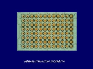 HEMAGLUTINACION INDIRECTA
 