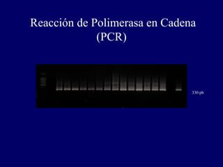 Reacción de Polimerasa en Cadena
             (PCR)



                               330 pb
 