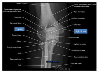 Cóndilo
          Epitróclea
 