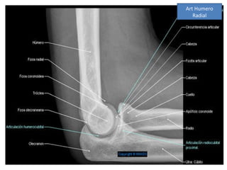 Art Humero
   Radial
 