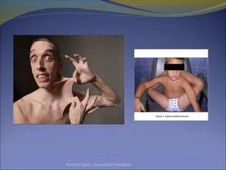 Andrea Puppio- Bioquímica Patológica-
 