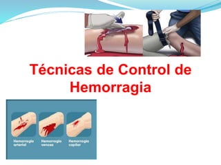 Técnicas de Control de
Hemorragia
 