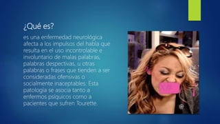 ¿Qué es?
es una enfermedad neurológica
afecta a los impulsos del habla que
resulta en el uso incontrolable e
involuntario de malas palabras,
palabras despectivas, u otras
palabras o frases que tienden a ser
consideradas ofensivas o
socialmente inaceptables. Esta
patología se asocia tanto a
enfermos psíquicos como a
pacientes que sufren Tourette.
 