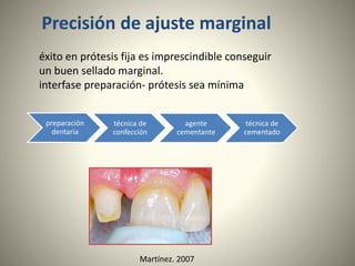 Coronas Dentales y Usos | PPTX