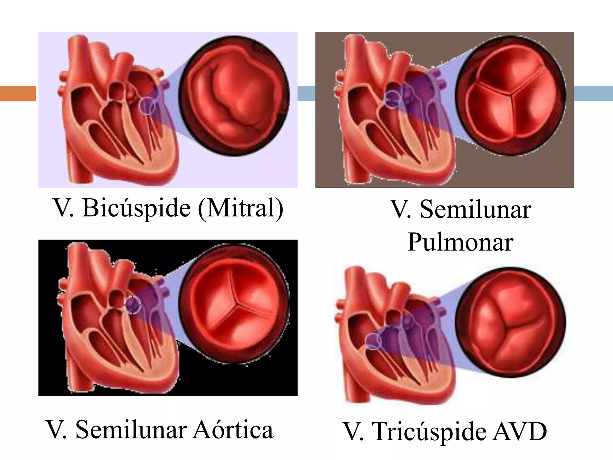 V. Bicúspide (Mitral) V. Semilunar
Pulmonar
V. Semilunar Aórtica V. Tricúspide AVD
 