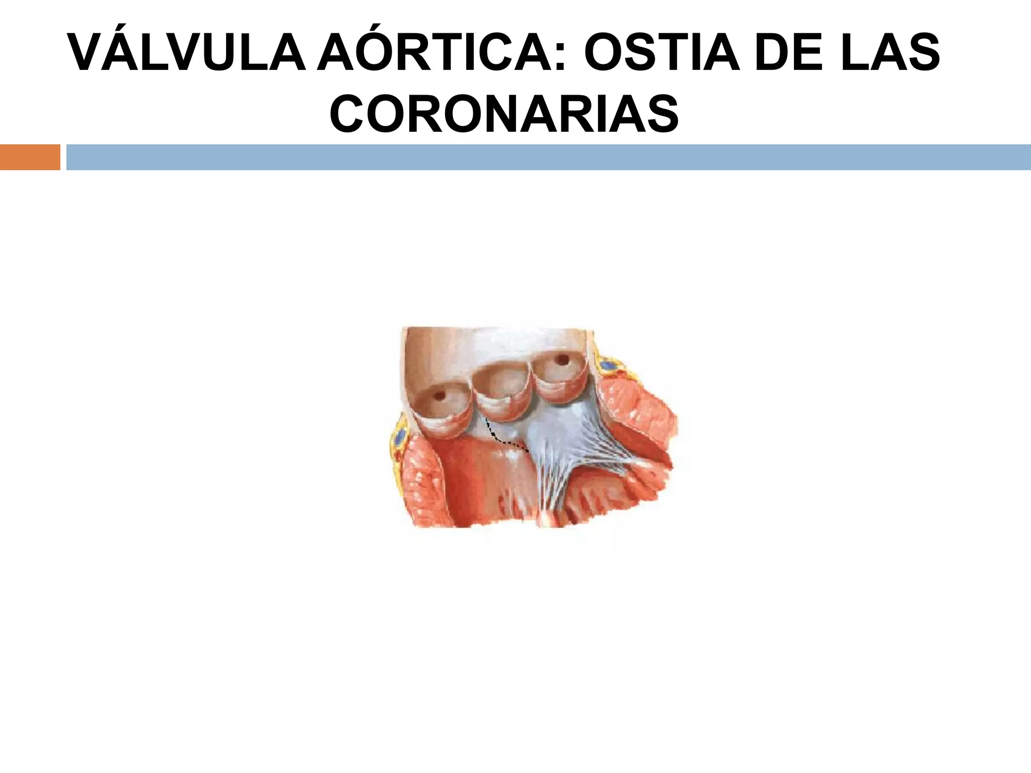 VÁLVULA AÓRTICA: OSTIA DE LAS
CORONARIAS
 