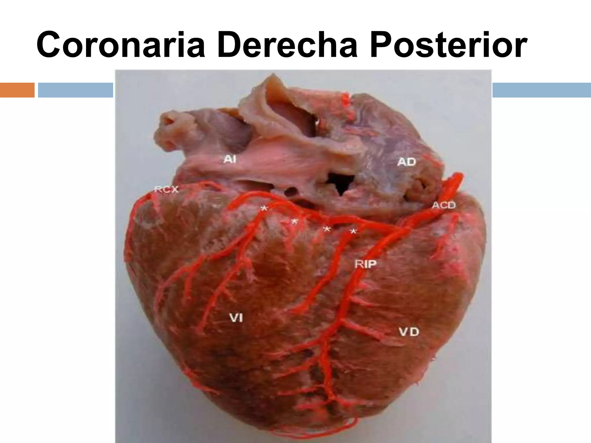 Coronaria Derecha Posterior
 