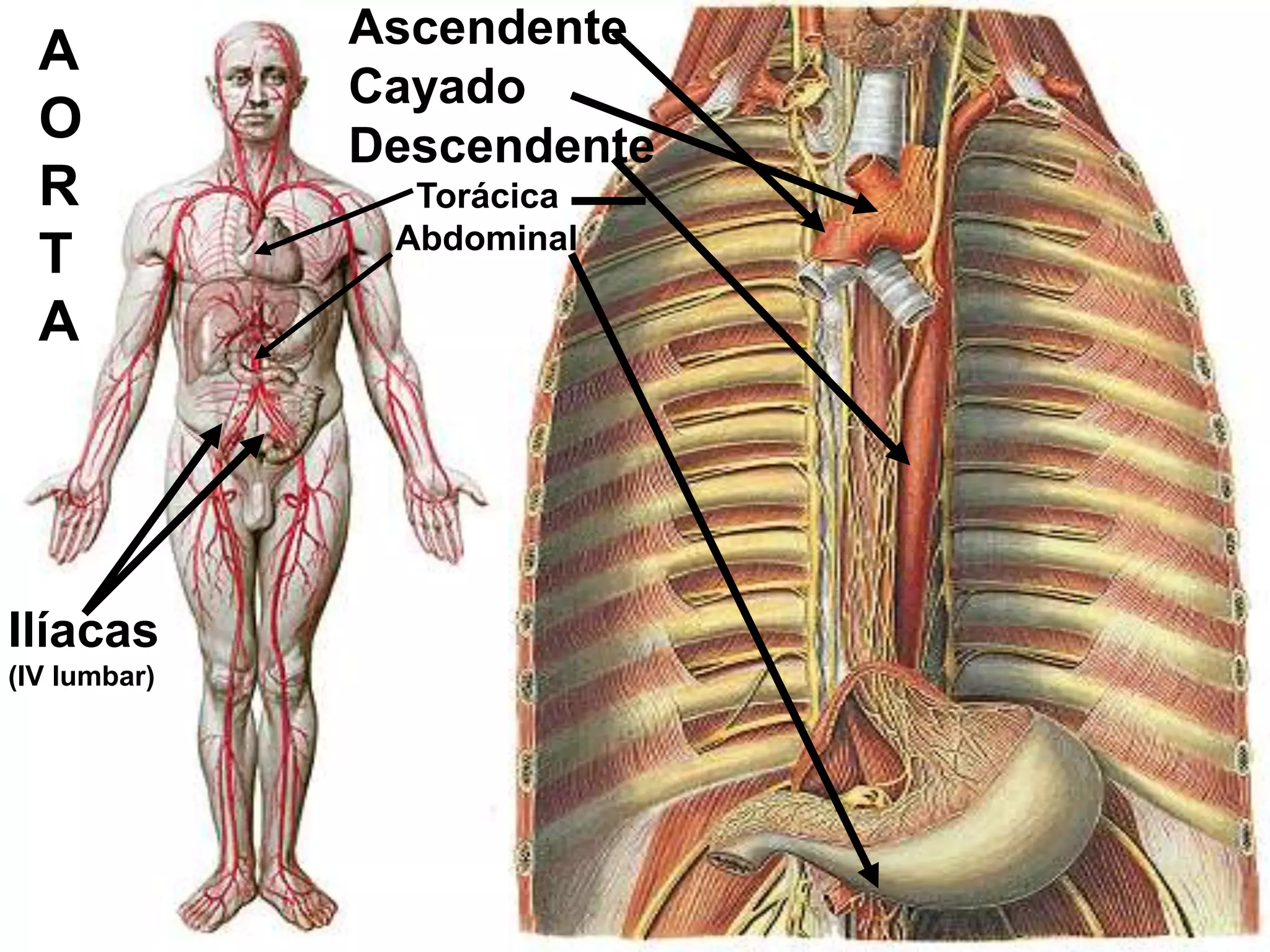 Ascendente
Cayado
Descendente
Torácica
Abdominal
A
O
R
T
A
Ilíacas
(IV lumbar)
 