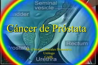 Cáncer de Próstata Dr. Christian Morales Dinamarca Urólogo CABL 