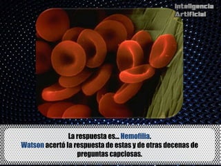 La respuesta es... Hemofilia.
Watson acertó la respuesta de estas y de otras decenas de
                  preguntas capciosas.
 