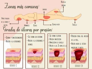 clase-de-escara-pptx