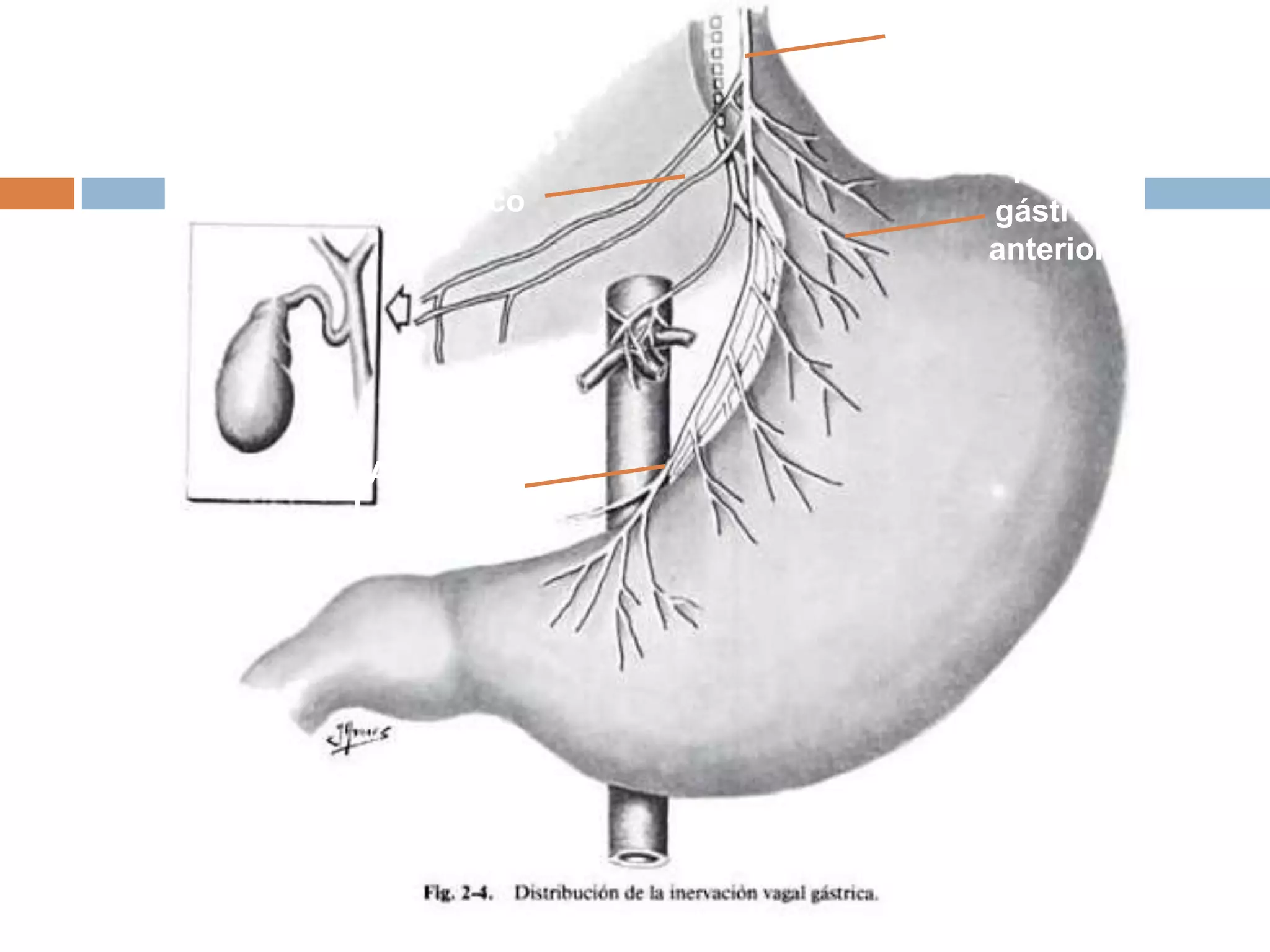 N. Anterior
Latarjet
Ramos
gástricos
anteriores
Vago izq o
anterior
Ramo
hepático
 