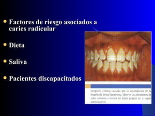    Factores de riesgo asociados a
    caries radicular

   Dieta

   Saliva

   Pacientes discapacitados
 