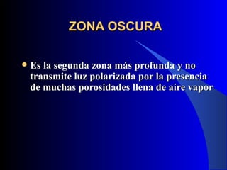 ZONA OSCURA

   Es la segunda zona más profunda y no
    transmite luz polarizada por la presencia
    de muchas porosidades llena de aire vapor
 