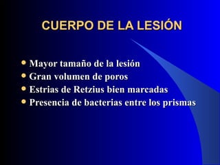CUERPO DE LA LESIÓN

 Mayor tamaño de la lesión
 Gran volumen de poros
 Estrias de Retzius bien marcadas
 Presencia de bacterias entre los prismas
 