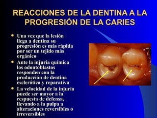 REACCIONES DE LA DENTINA A LA
  PROGRESIÓN DE LA CARIES
   Una vez que la lesión
    llega a dentina su
    progresión es más rápida
    por ser un tejido más
    orgánico
   Ante la injuria química
    los odontoblastos
    responden con la
    producción de dentina
    esclerótica y reparativa
   La velocidad de la injuria
    puede ser mayor a la
    respuesta de defensa,
    llevando a la pulpa a
    alteraciones reversibles o
    irreversibles
 