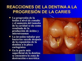 REACCIONES DE LA DENTINA A LA
  PROGRESIÓN DE LA CARIES
    La progresión de la
     lesión a nivel de esmalte
     y el aumento del tamaño
     de la cavidad se da como
     resultado de la
     producción de ácidos y
     microtraumas
    La invasión tubular por
     bacterias sucede después
     de la exposición de la
     dentina a la placa
     cariogénica
    En la parte más
     superficial de la dentina
     se encuentra la zona de
     destrucción o necrótica
 