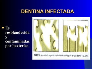 DENTINA INFECTADA


   Es
    resblandecida
    y
    contaminadas
    por bacterias
 