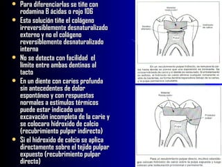    Para diferenciarlas se tiñe con
    rodamina B ácidas o rojo 106
   Esta solución tiñe el colágeno
    irreversiblemente desnaturalizado
    externo y no el colágeno
    reversiblemente desnaturalizado
    interna
   No se detecta con facilidad el
    límite entre ambas dentinas al
    tacto
   En un diente con caries profunda
    sin antecedentes de dolor
    espontáneo y con respuestas
    normales a estímulos térmicos
    puede estar indicado una
    excavación incompleta de la carie y
    se colocara hidroxido de calcio
    (recubrimiento pulpar indirecto)
   Si el hidroxido de calcio se aplica
    directamente sobre el tejido pulpar
    expuesto (recubrimiento pulpar
    directo)
 