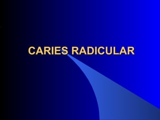 CARIES RADICULAR
 