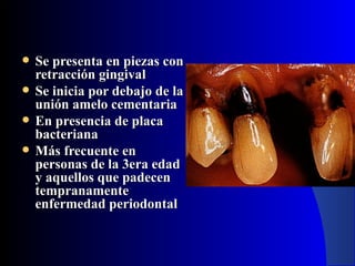    Se presenta en piezas con
    retracción gingival
   Se inicia por debajo de la
    unión amelo cementaria
   En presencia de placa
    bacteriana
   Más frecuente en
    personas de la 3era edad
    y aquellos que padecen
    tempranamente
    enfermedad periodontal
 