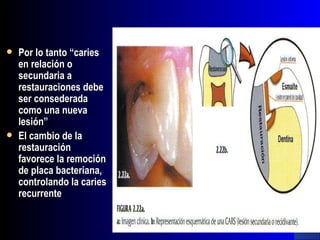    Por lo tanto “caries
    en relación o
    secundaria a
    restauraciones debe
    ser consederada
    como una nueva
    lesión”
   El cambio de la
    restauración
    favorece la remoción
    de placa bacteriana,
    controlando la caries
    recurrente
 