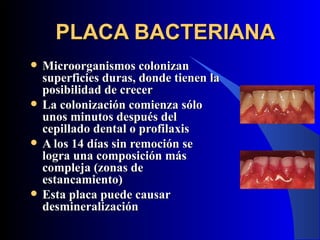 PLACA BACTERIANA
   Microorganismos colonizan
    superficies duras, donde tienen la
    posibilidad de crecer
   La colonización comienza sólo
    unos minutos después del
    cepillado dental o profilaxis
   A los 14 días sin remoción se
    logra una composición más
    compleja (zonas de
    estancamiento)
   Esta placa puede causar
    desmineralización
 