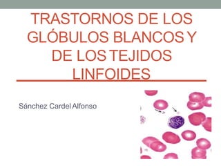 TRASTORNOS DE LOS
GLÓBULOS BLANCOSY
DE LOSTEJIDOS
LINFOIDES
Sánchez Cardel Alfonso
 