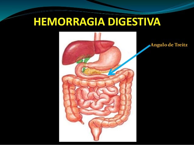 Ángulo De Treitz: Anatomía Y Funciones – MVWEI