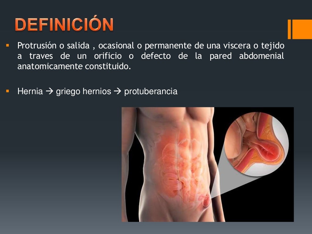 Quem Tem Hernia Inguinal Pode Andar De Bicicleta