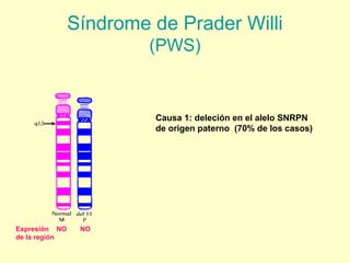 Síndrome de Prader Willi 
(PWS) 
Causa 1: deleción en el alelo SNRPN 
de origen paterno (70% de los casos) 
Expresión NO NO 
de la región 
 