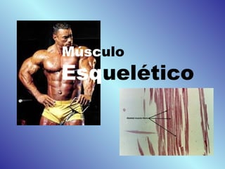 Músculo
Esquelético
 