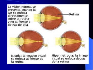 Clase de optica