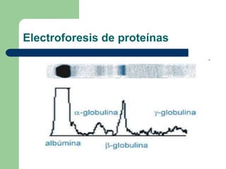 Electroforesis de proteínas
 