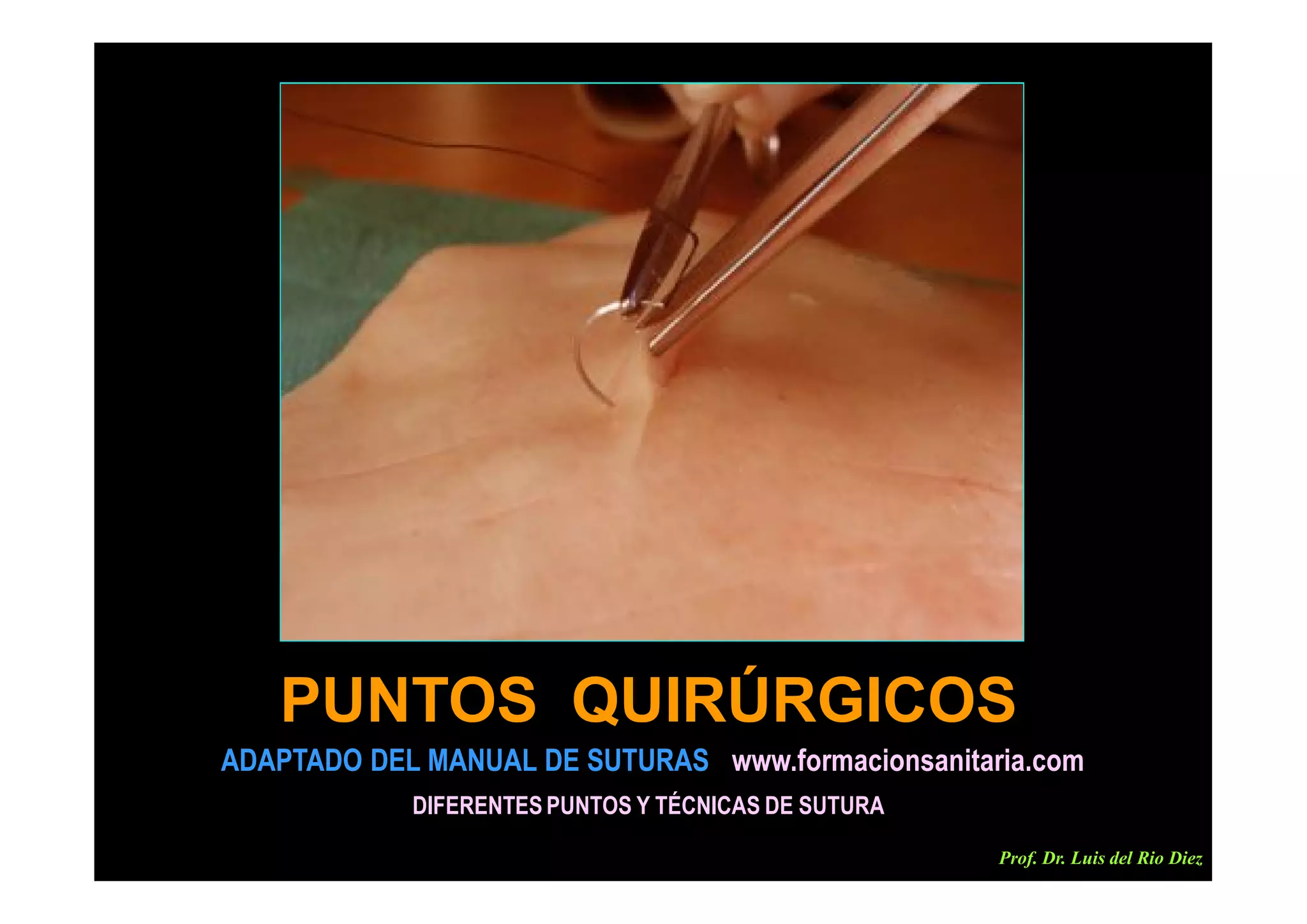CLASE SOBRE PUNTOS QUIRÚRGICOS, TIPOS Y TÉCNICAS. PROF. DR. LUIS DEL