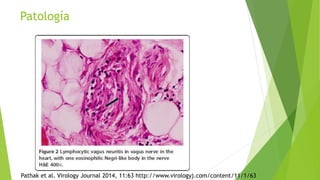 Patología
Pathak et al. Virology Journal 2014, 11:63 http://www.virologyj.com/content/11/1/63
 