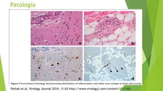Patología
Pathak et al. Virology Journal 2014, 11:63 http://www.virologyj.com/content/11/1/63
 