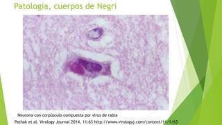 Patología, cuerpos de Negri
Neurona con corpúsculo compuesta por virus de rabia
Pathak et al. Virology Journal 2014, 11:63 http://www.virologyj.com/content/11/1/63
 