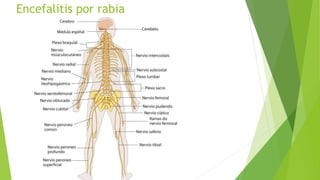 Encefalitis por rabia
 