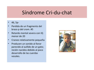 Síndrome Cri-du-chat
• 46, 5p-
• Perdida de un fragmento del
brazo p del crom. #5
• Retardo mental severa con IQ
menor de 20
• Craneo relativamente pequeña
• Producen un sonido al llorar
parecido al aullido de un gato;
recién nacidos debido al poco
desarrollo de las cuerdas
vocales.
 