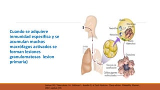 Cuando se adquiere 
inmunidad especifica y se 
acumulan muchos 
macrófagos activados se 
forman lesiones 
granulomatosas lesion 
primaria) 
Iseman MD. Tuberculosis. En: Goldman L. Ausellio D, et Cecil Medicine. 23ava edicion. Philadelfia, Elsevier ; 
2007, capitulo 345 
 