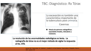 TBC: Diagnóstico: Rx Tórax 
La excavación es también una 
característica importante de 
la tuberculosis post-primaria. 
Cavernas 
 Mezcla de patrones radiográficos: 
opacidades lineales, reticulares y 
nodulares. 
La resolución de las anormalidades radiológicas es lenta. La 
radiografía de tórax no es el mejor método de vigilar la respuesta 
al tto. ATB. 
Iseman MD. Tuberculosis. En: Goldman L. Ausellio D, et Cecil Medicine. 23ava edicion. Philadelfia, Elsevier ; 
2007, capitulo 345 
 
